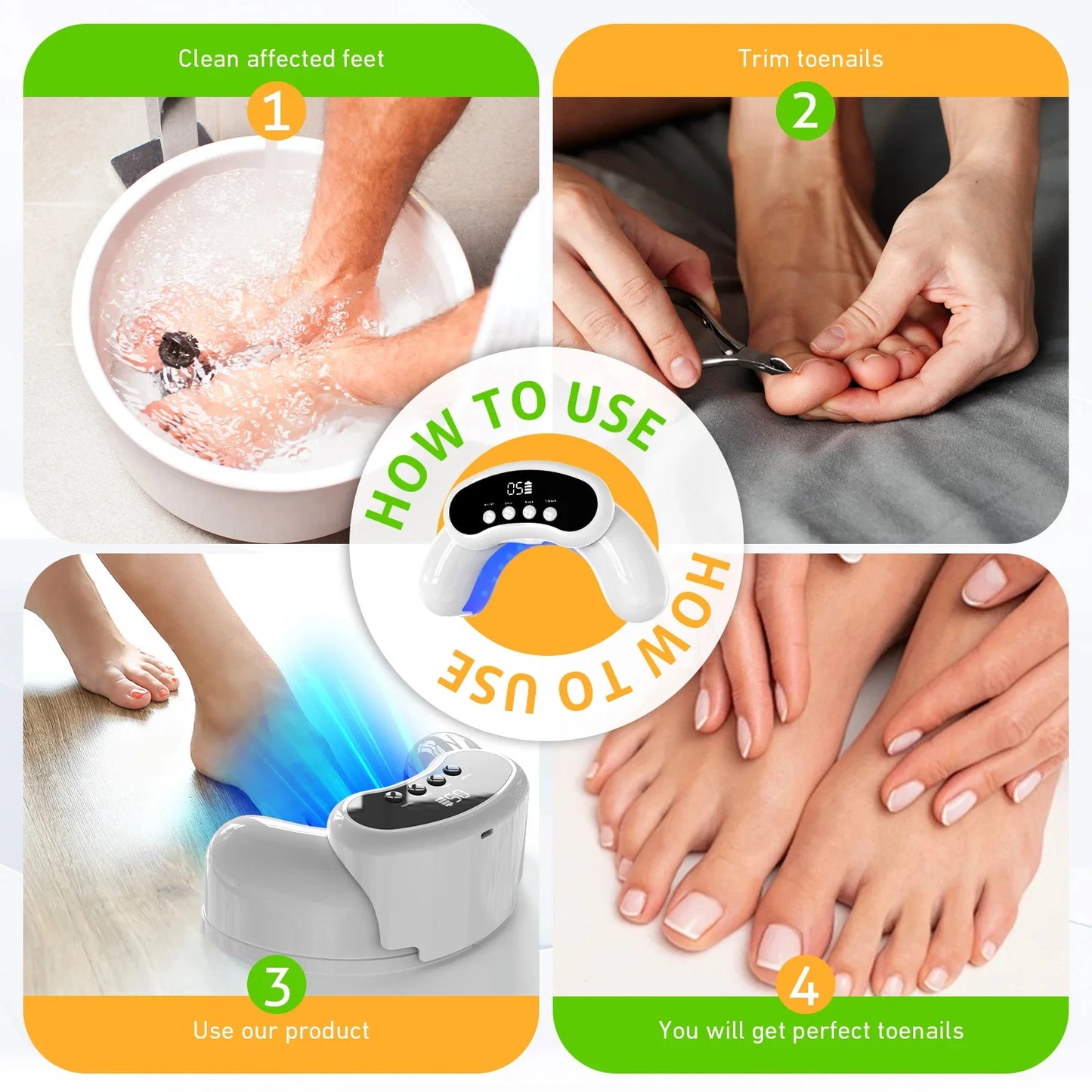 Nail Fungus Laser Treatment Device Fingernail Fungus Treat Onychomycosis Therapy Effectively Remove Onychomycosis Grow Toe Nail